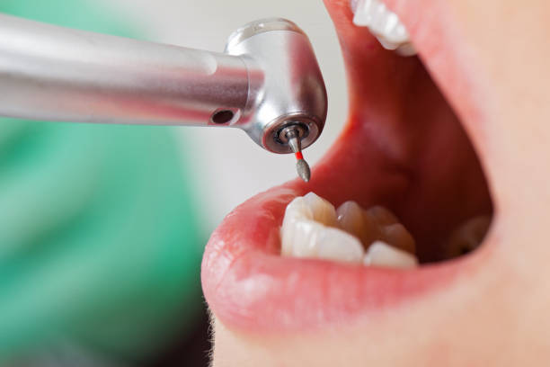 Best Urgent Tooth Repair  in Oberlin, OH